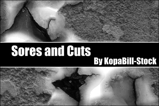 sores-and-cuts-brushes