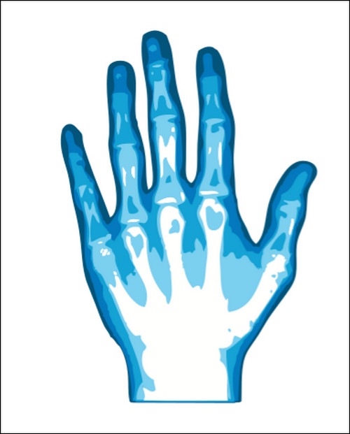 x-ray-hand-hand-vector